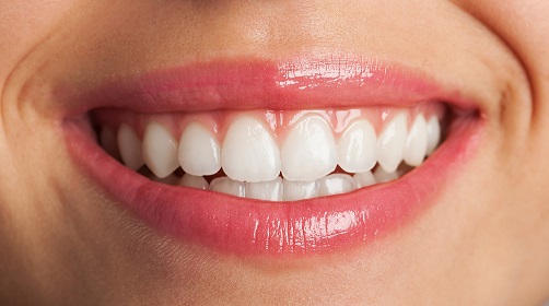 teeth straightening guide for all age group
